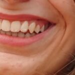 Buona resa ma prezzo... - Foto 1 Buona resa ma prezzo... - Foto 1